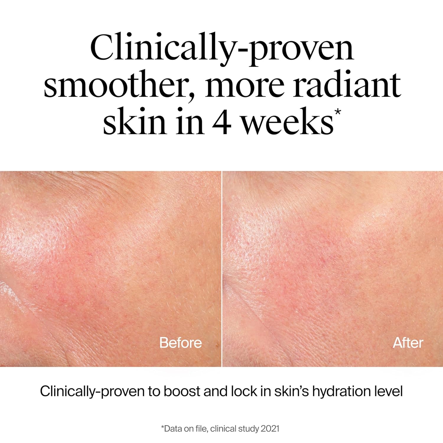 Neutrogena Hydro Boost Hydrating Cleanser Gel - Hyaluronic Acid, 7.8 oz