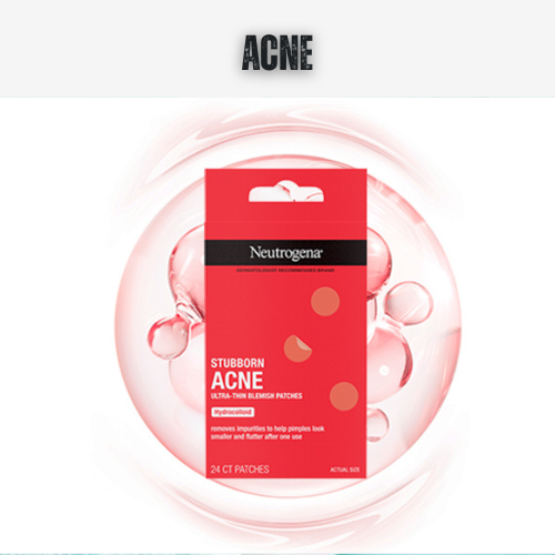 Neutrogena Stubborn Acne Ultra Thin Blotting Patches packaging on a white background with 'ACNE' text above.